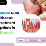 Advanced Gum Disease: Treatment Options in Sharjah