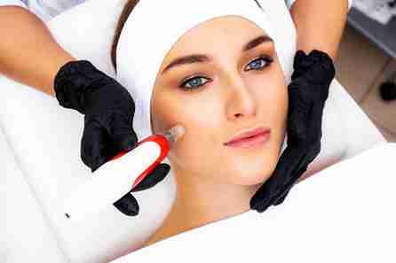 Discreet Laser Hair Removal for Naturally Smooth Skin