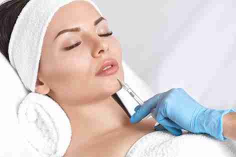 Expert Lip Filler Treatments for a Youthful Appearance