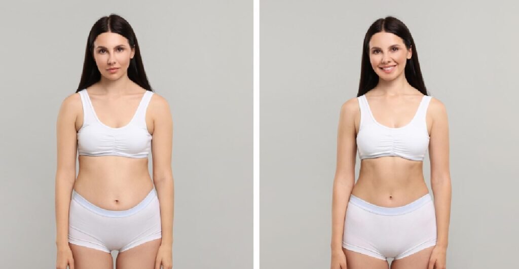 liposuction antalya