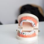 TMJ treatment