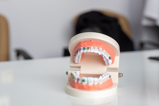 TMJ Treatment Options: A Comprehensive Guide to Non Surgical Therapies