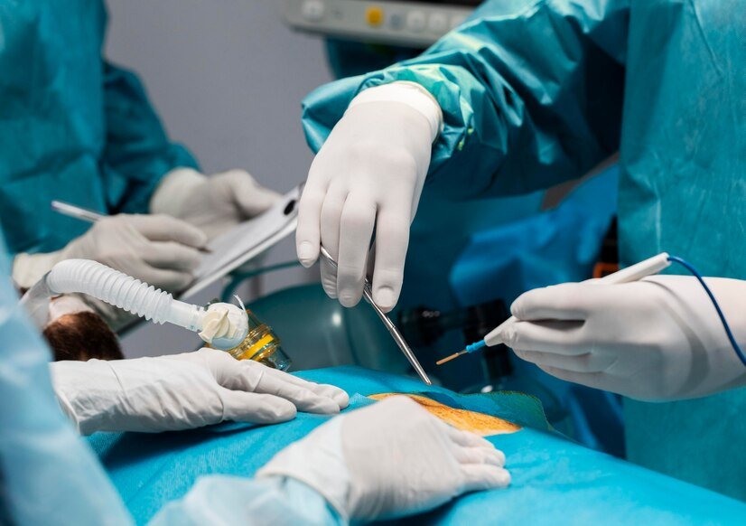 How Minimally Invasive Gynecology Is Advancing with Modern Morcellation Tools