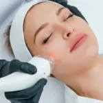 Revitalize Your Glow: Laser Skin Rejuvenation in Beverly Hills