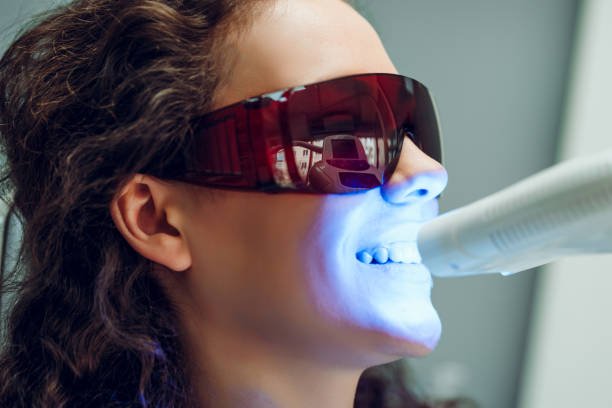 Zoom vs. Laser: The Battle of High-Tech Treatments Teeth Whitening in Riyadh