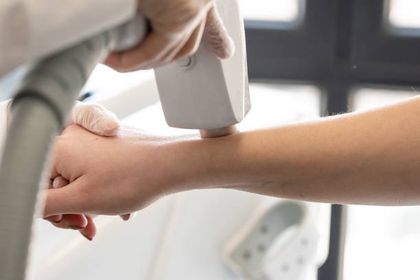 Cultural Confidence: How Laser Hair Removal Aligns with Beauty Norms in Abu Dhabi