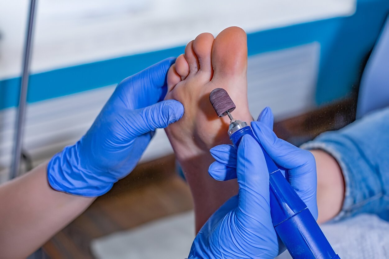 Podiatry Billing Services