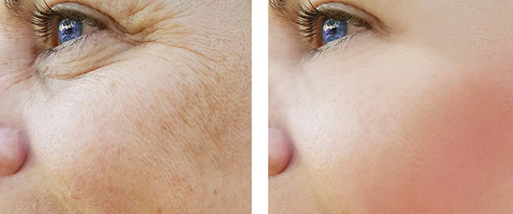 How to Achieve Radiant, Youthful Skin: A Complete Guide to Skin Rejuvenation Treatments