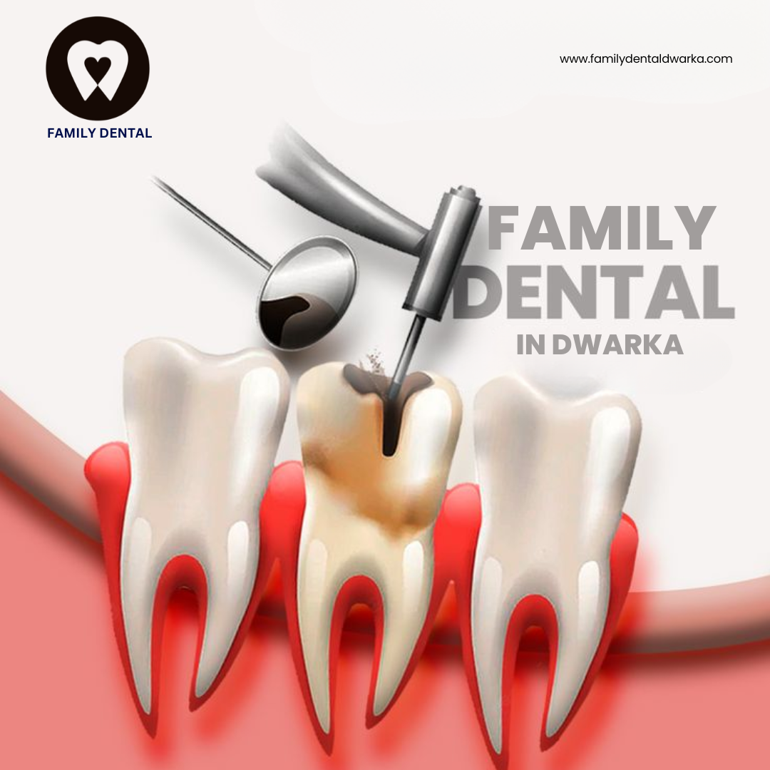 Best Dentist in Dwarka for Painless Dental Care Dr. Mahima Yadav