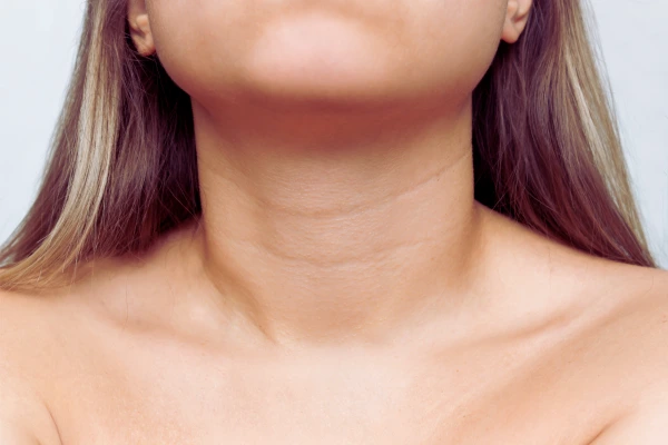 Achieve a Smoother Neckline at Dynamic Aesthetic Clinic