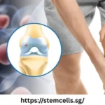 Stem Cell Treatment Singapore for joint pain