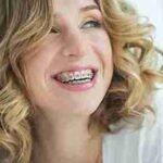 The Clean Finish Your Smile Has Been Missing in a Taunton