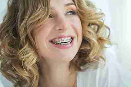 The Clean Finish Your Smile Has Been Missing in a Taunton