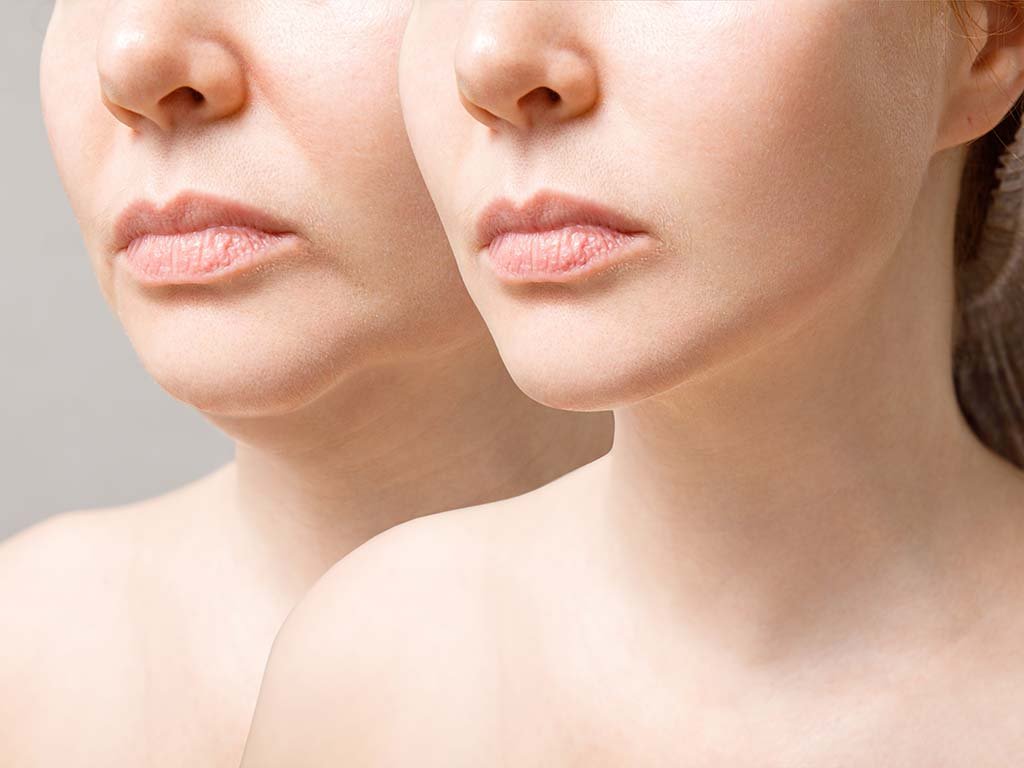 What Are the Most Popular Facial Plastic Surgery Procedures in Hawaii?