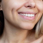 Dimple Creation Surgery in Dubai
