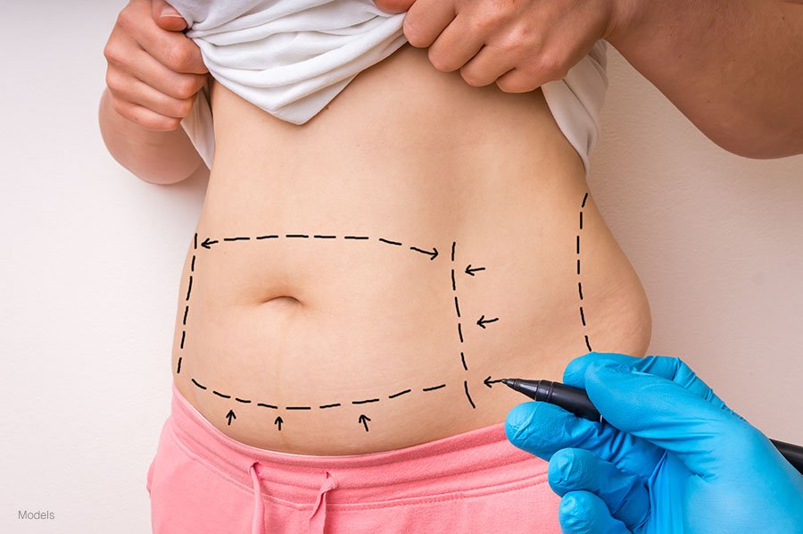 Want Safe and Expert Tummy Tuck? Go to Dynamic Life Clinics
