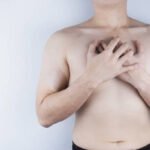 Gynecomastia Surgery in Riyadh