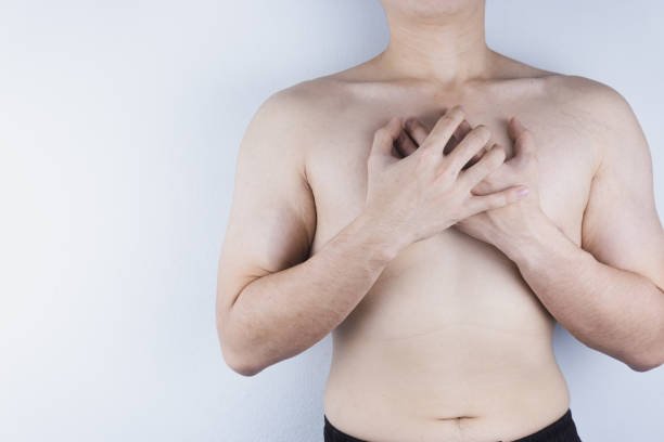 Choosing the Best Clinic for Gynecomastia Surgery in Riyadh: Key Factors to Consider