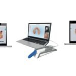 Use Cases for Intraoral Scanners