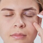 Blepharoplasty Dubai