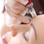 Botox Beverly Hills