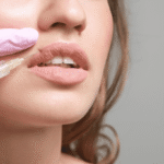 Russian Lip Fillers in Dubai