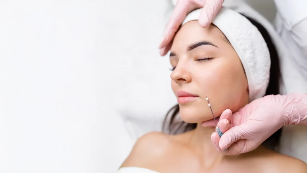 Does Silhouette Soft Thread Lift Reduce Wrinkles?