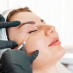 Undereye Filler Treatment Dubai