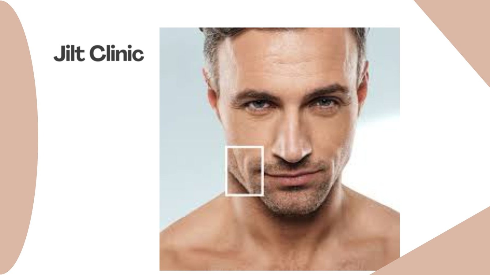 fett weg spritze zürich