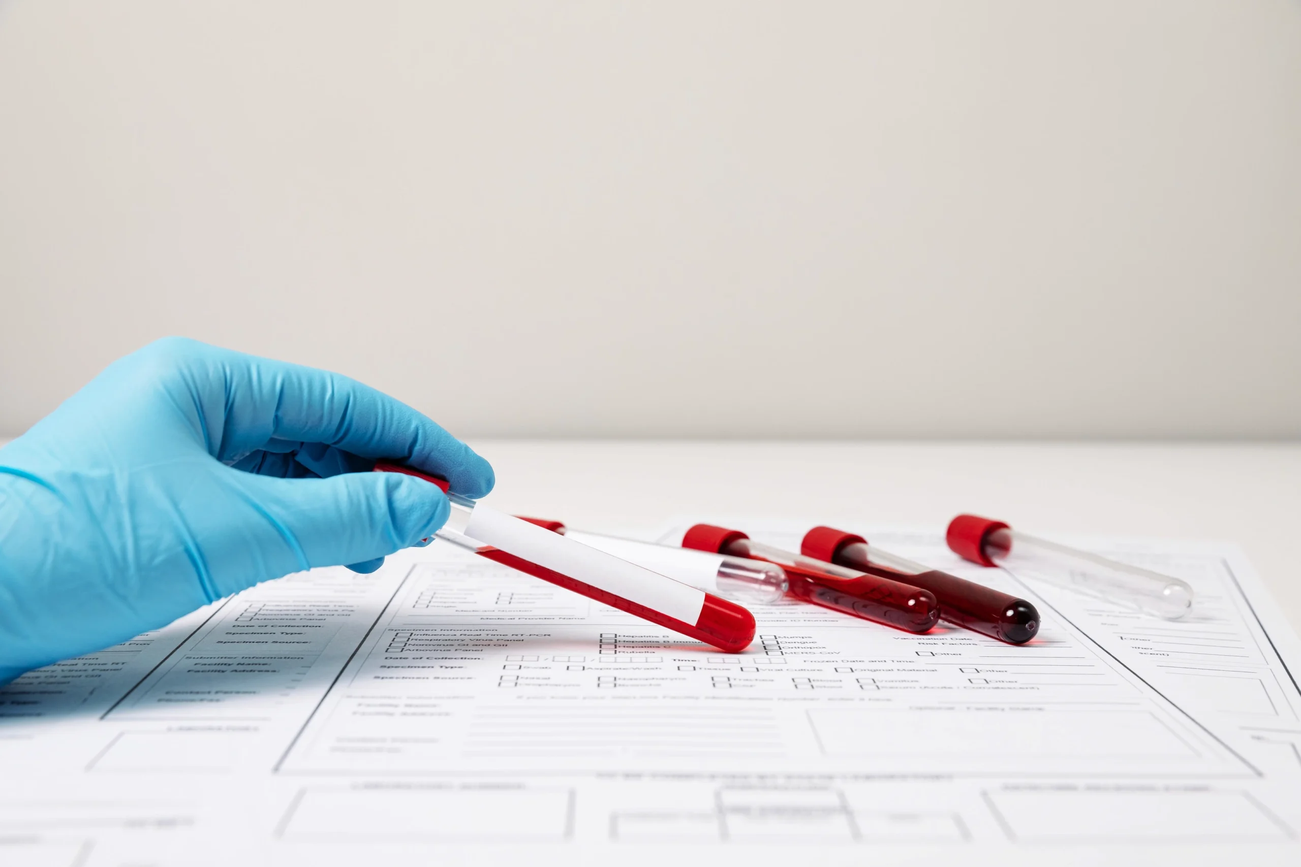 Blood Test At Home: The Comfort Your Health Deserves