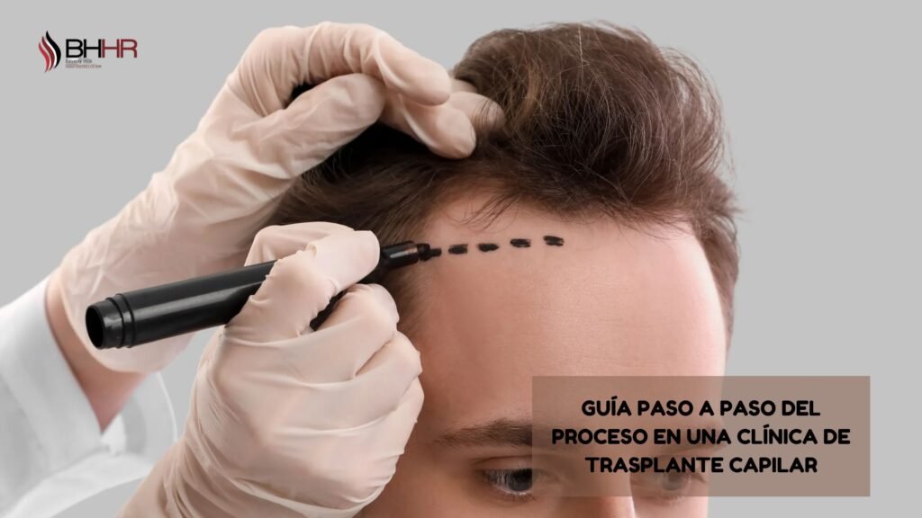 clinica de trasplante capilar