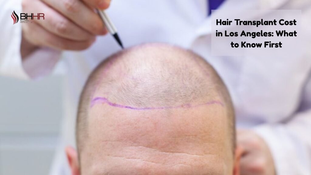 hair transplant cost los angeles