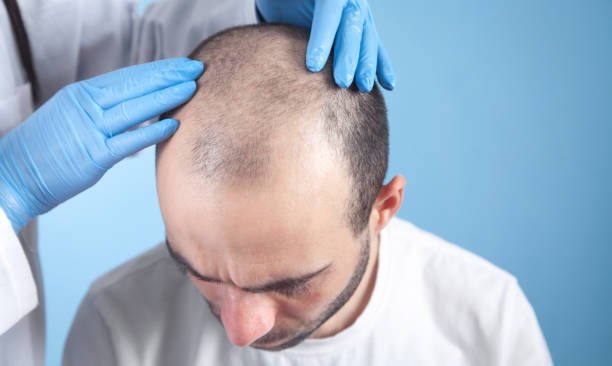 Hair Transplant Solutions at Dynamic Life Clinics
