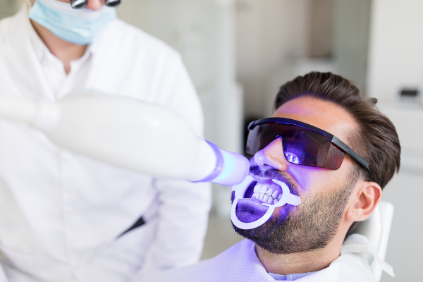 Understanding Teeth Sensitivity After Whitening: A UK Perspective
