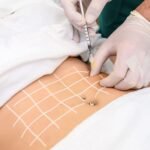 Aqualyx Injection Dubai