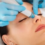 Hydrafacial in Dubai
