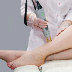 Laser Hair Removal in Dubai