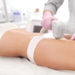 Laser Hair Removal in Dubai