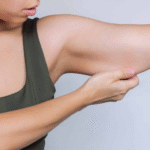 Arm Lift in Dubai