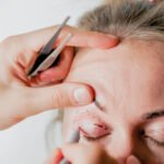 Blepharoplasty Dubai