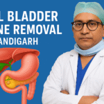 Gall Bladder Stone Removal In Chandigarh