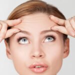 Forehead Lift in Dubai