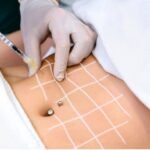 Aqualyx Injection Dubai