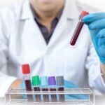 How Health Blood Tests in Leicester Can Give You Peace of Mind