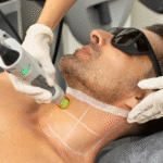 Laser Hair Removal in Dubai