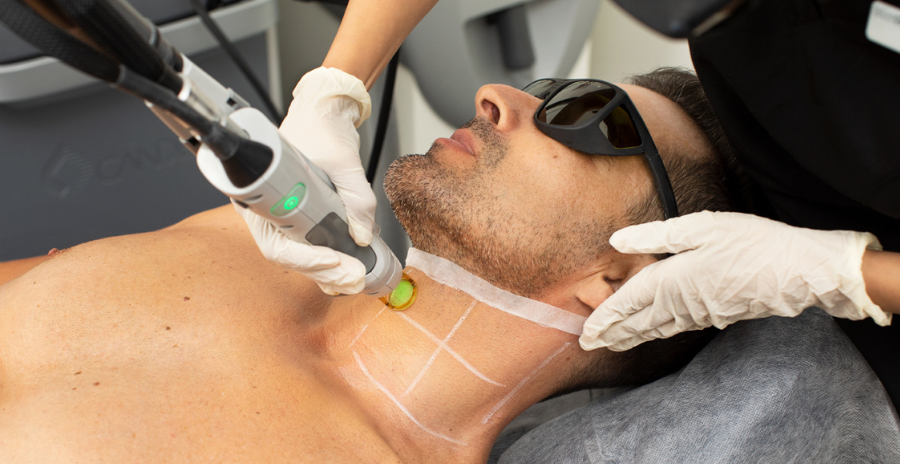 Laser Hair Removal in Dubai