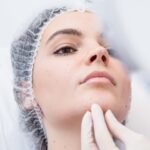 Rhinoplasty in Riyadh