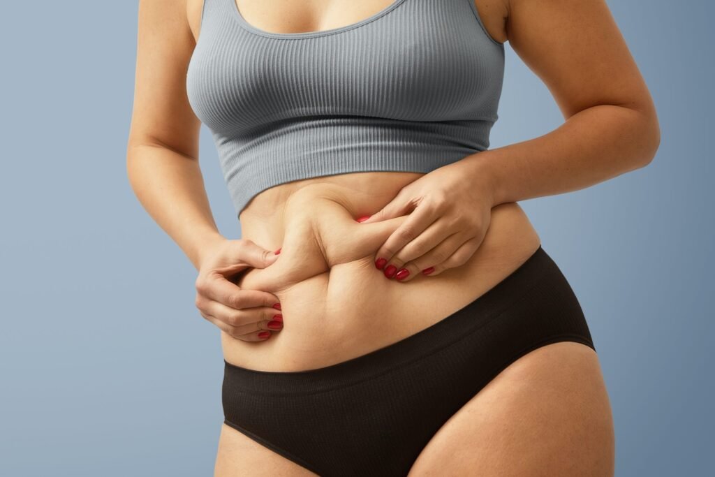 Tummy Tuck Dubai