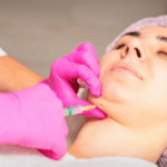 Kybella Treatment for Double Chin in Dubai