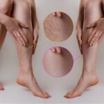 vein treatment specialist